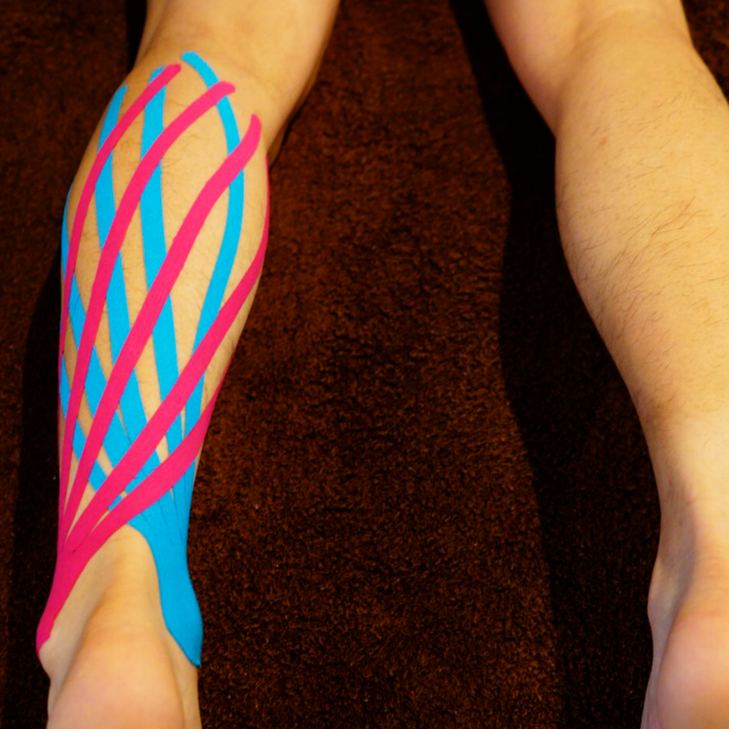 特殊なキネシオテーピングを貼付された足の写真